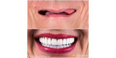 CENTRO DE CAPACITACIÓN DE PRÓTESIS DENTAL JAMER LEÓN